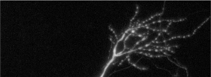 Activated microglia promote excitotoxic injury