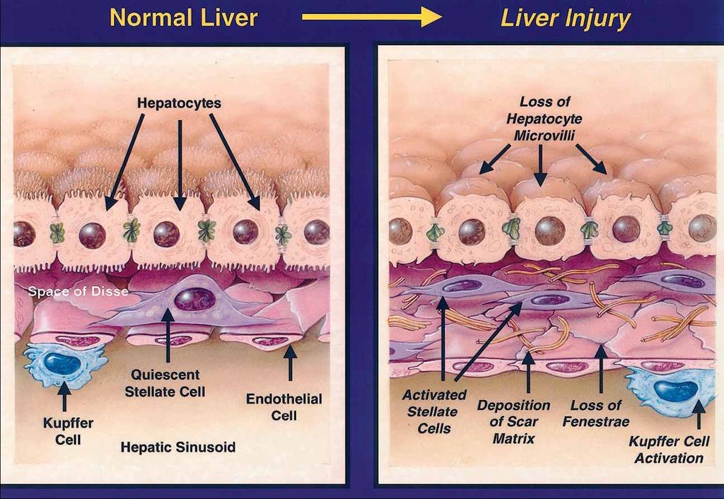 Lesson #3 Healthy Hepatocytes Injured/Dying Hepatocytes No cell is an island (We get by with a
