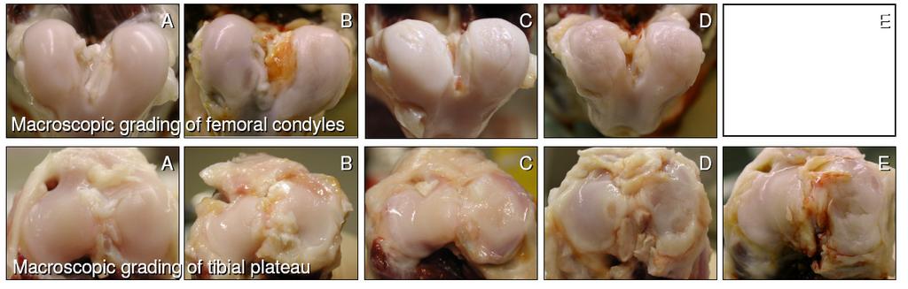 Macroscopic assessment of cartilage E A Smooth surface 0 B Slightly fibrillated/roughened surface 1 C