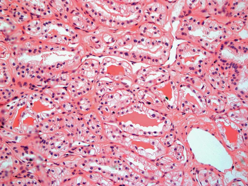 renal cell