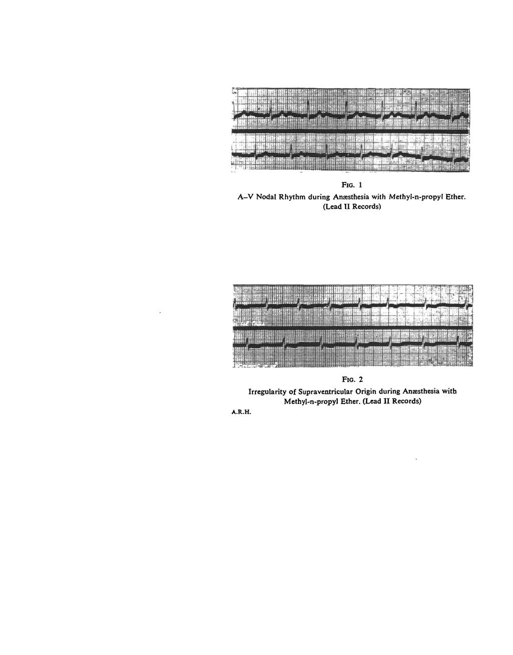 FIG. 1 A-V Nodal Rhythm during Anaesthesia with Methyl-n-propyl Ether. (Lead II Records) A.R.H. FIG.