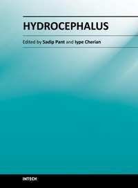 Hydrocephalus Edited by Dr Sadip Pant ISBN 978-953-51-0162-8 Hard cover, 214 pages Publisher InTech Published online 24, February, 2012 Published in print edition February, 2012 Description of
