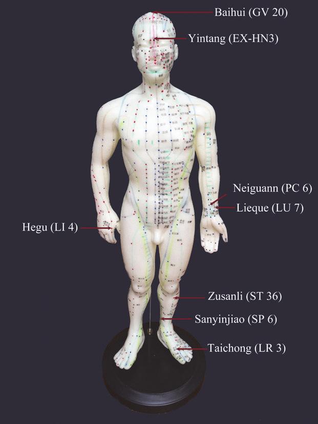Evidence-Based Complementary and Alternative Medicine 3 Baihui (GV 20) Yintang (EX-HN3) Jiaogan (AH6) Shenmen (TF 4) Hegu (LI 4) Neiguann (PC 6) Lieque (LU 7) Zusanli (ST 36) Sanyinjiao (SP 6)