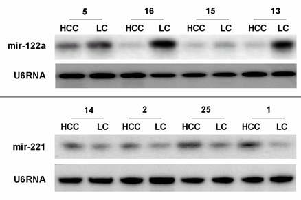 mir-221 is up-regulated in human hepatocellular carcinoma and