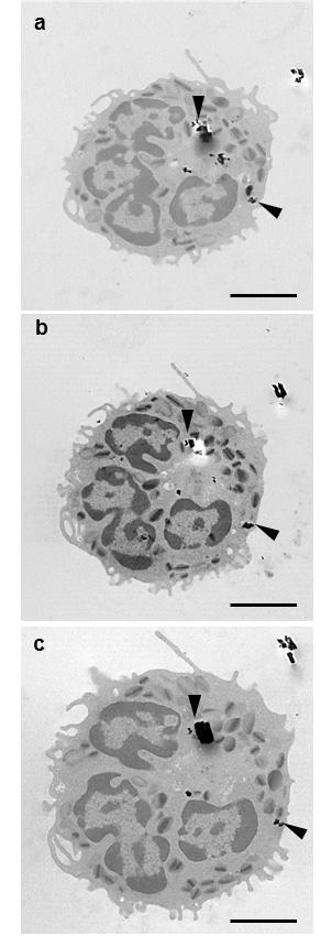 Figure S7. Serial sections of the same eosinophil spanning 300 nm in depth.