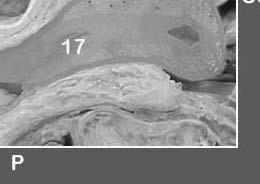 A) Anterior, C) Caudad, P) Posterior, Ce) Cephalad, 1) Pubic bone, 2) Space of Retzius, 3) Urethrovaginal sphincter, 4)