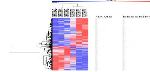 Supplementary Table 1 Gene sets Up in cachec=c Mouse myotubes GALINDO_IMMUNE_RESPONSE_TO_ENTEROTOXIN ICHIBA_GRAFT_VERSUS_HOST_DISEASE_D7_UP BAKKER_FOXO3_TARGETS_UP MIZUSHIMA_AUTOPHAGOSOME_FORMATION