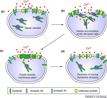 Dysferlin s Function Membrane repair Satellite cells T-tubules Mitochondria Dysferlinopathy Onset