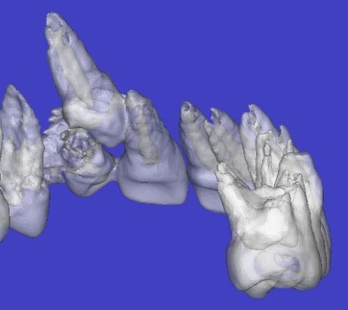 unerupted tooth. These include the position and mobility of adjacent teeth.