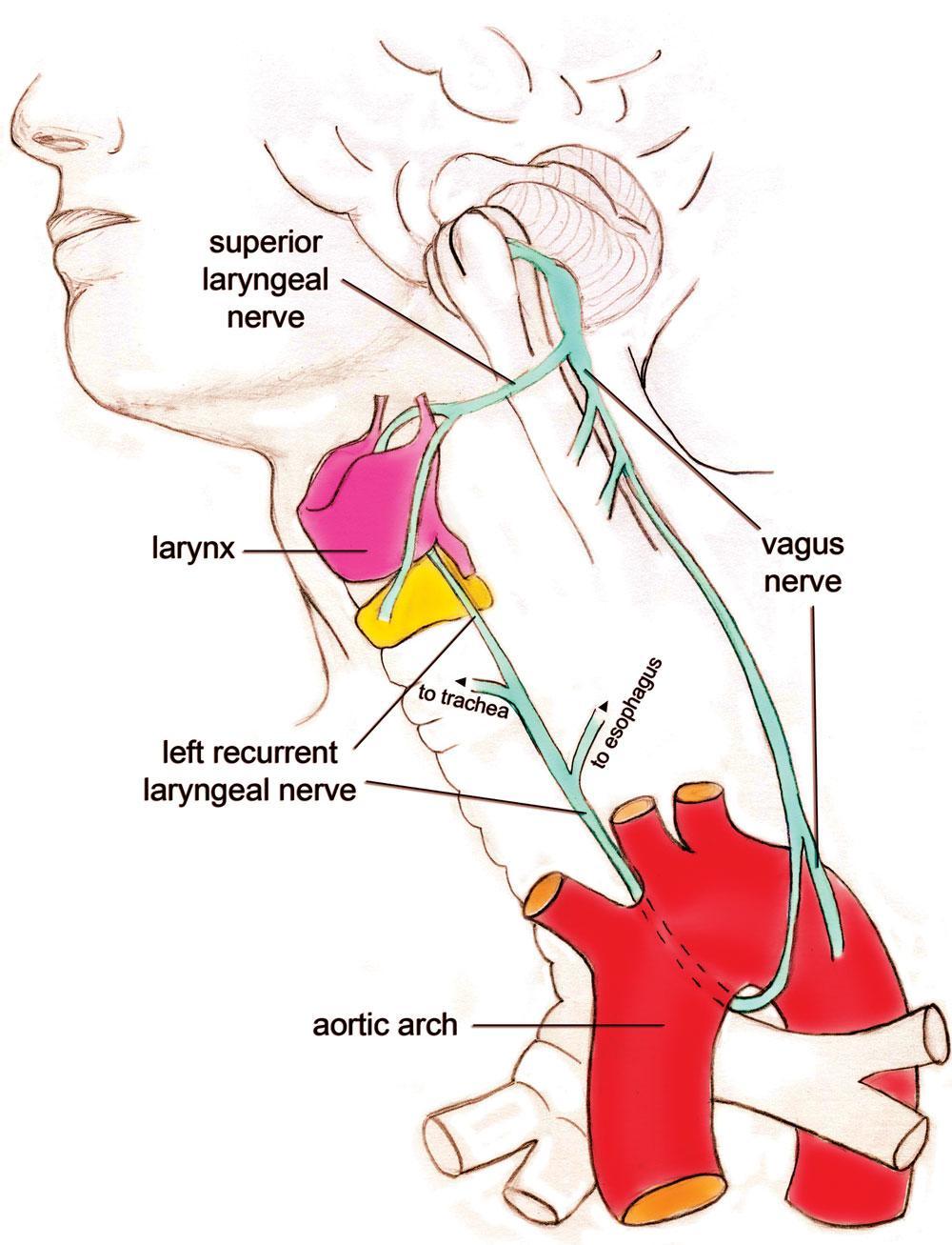Nerve Supply and Semon s Law: 10 Motor: All intrinsic muscles are supplied by recurrent laryngeal nerve of vagus nerve EXCEPT cricothyroid, it s supplied by external laryngeal nerve of superior