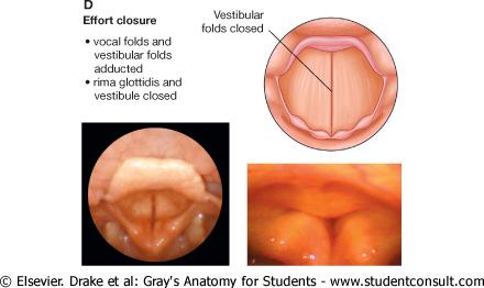 Effort closure Effort closure of the larynx occurs when air is retained in the thoracic cavity to stabilize the trunk For example during heavy lifting, or as part of the mechanism for