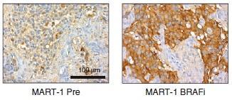 Blocking the MAPK Signaling Pathway Results in Changes in the Tumor Microenvironment