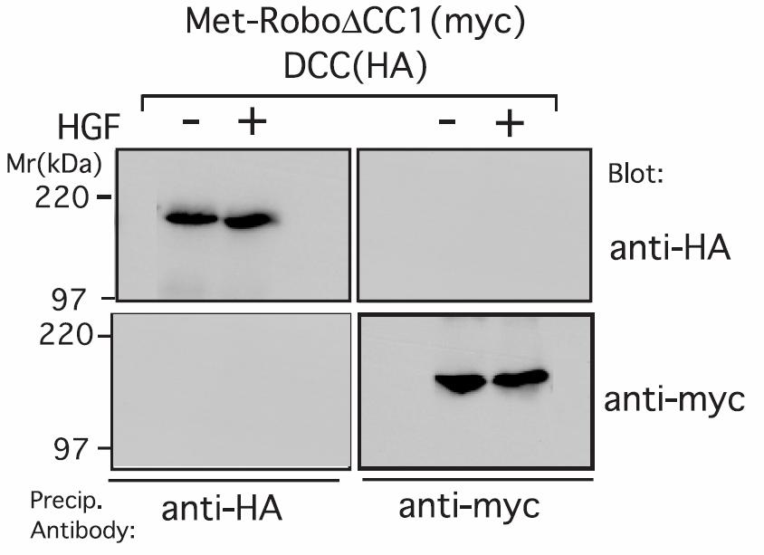 Yeast two-hybrid analysis of the interaction between the cytoplasmic domains of DCC (as a LexA fusion bait) and Robo1 (as a VP16 fusion prey) DCC Robo LexA VP16 DCC cytoplasmic domain deletion