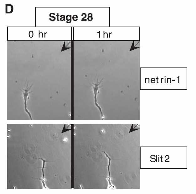 The finding that Slit silences netrin-1 attraction of stage growth cones but does not repel them was unexpected, because Slit is expected to function as a repellent.