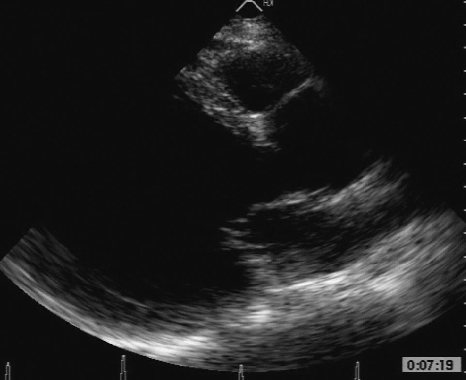 40 Fig. 3. Echocardiography parasternal view.