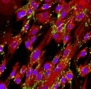 Endocytosis of Nanoparticles Reinhard Lipowsky Theory & Bio-Systems, MPI-CI, Potsdam Motivation: Cellular Uptake