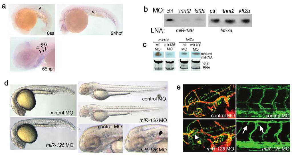 Supplementary Figure 8. Effects of mir-126 deficiency on zebrafish development.