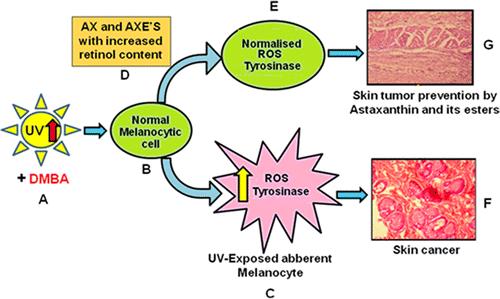 The Protective Role of carotenoids on UV-DMBA induced Skin Carcinogenesis Rats:
