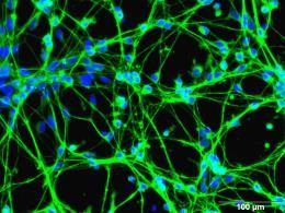 Triggering of degeneration of human neurons by