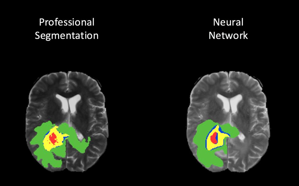 Output and Opportunities Output The model can accurately identify each of the four classes Potential Opportunities A single patient will produce upwards of 600 images from a single MRI, given that