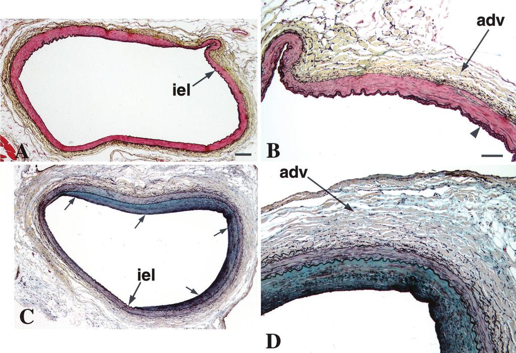1918 Circulation April 10, 2001 Figure 5. Edge effects at 12 months. Arterial segment distal to control stent (A and B) and 48- Ci stent (C and D) are shown.