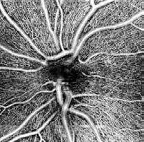 information in the diagnosis of many retinal diseases.