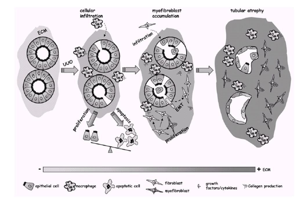 The Unilateral Ureteral Obstruction (UUO) model of kidney fibrosis in vivo model encompasses