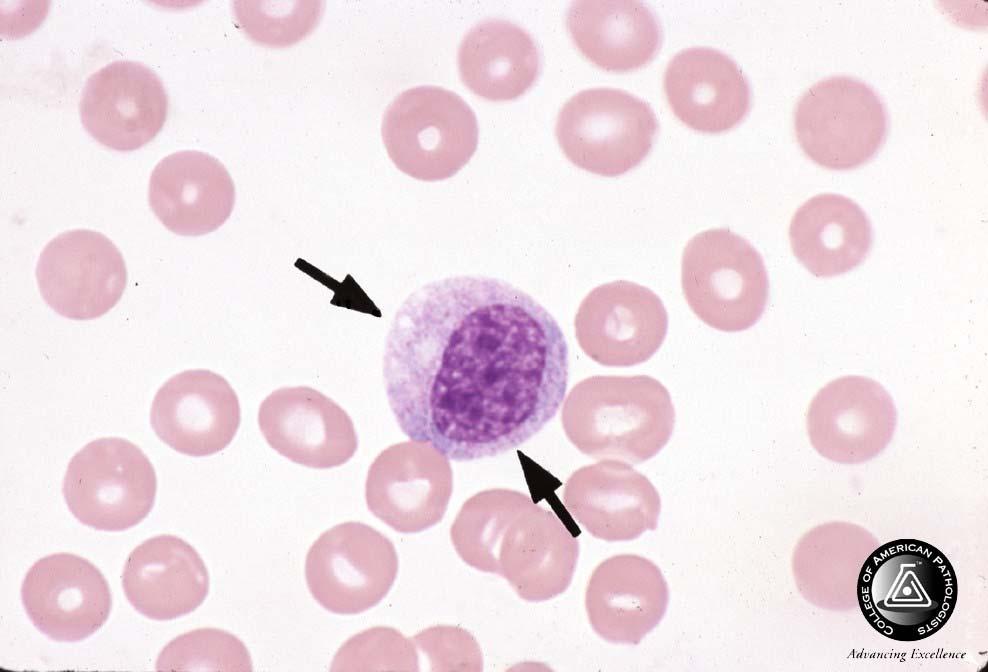 Blood Cell Identification Ungraded BCK/BCP-18 BCK BCP Referees Participants Participants Performance Identification No. % No. % No. % Evaluation Neutrophil, myelocyte 16 100.0 3093 82.3 1307 79.