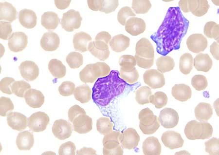 frequently present, being large lymphocytes with round to oval nuclei containing one or more prominent nucleoli. The cytoplasm of an immunoblast is abundant and deeply basophilic.