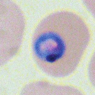 The L272F mutation (blue dot) is