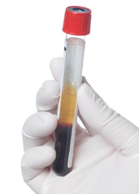 Stabilnost kalija, natrija, klorida i indeksa hemolize u uzorku seruma neodvojenog