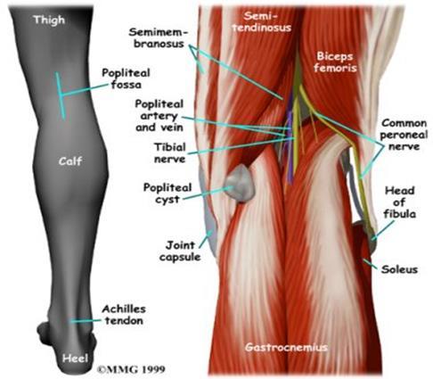 Clinical Relevance: 1. Swelling in the Popliteal Fossa The appearance of a mass in the popliteal fossa has many differential diagnoses.