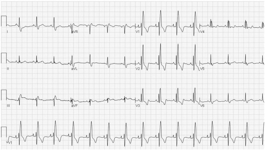67 year old man, hypertension, routine assessment 1.