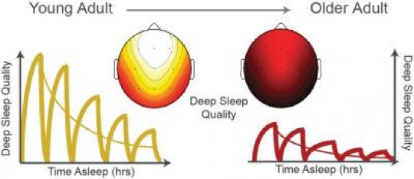 Older adults Sleep pattern changes with age Neural