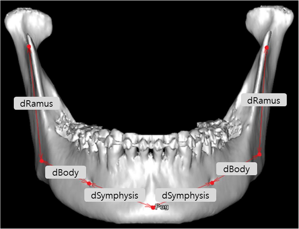 Yoon et al. Maxillofacial Plastic and Reconstructive Surgery (2018) 40:30 Page 3 of 6 Fig. 1 Functional subunit of the mandible.