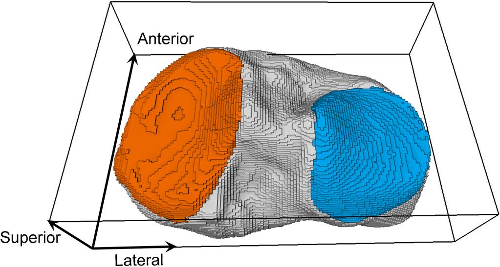 Fig. 1. Illustration of a 3D ROI (wire box). Volume rendering of segmentation masks of tibial bone (gray), medial tibial cartilage (orange), and lateral tibial cartilage (blue).