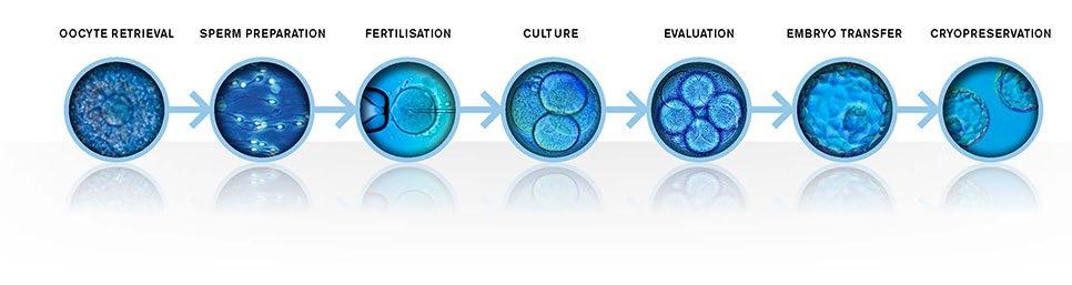 IVF PRESENT-THE PROCESS DAY 0 DAY 1-5 DAY 3-5