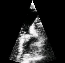 Introduction 5 1.3 Echocardiography A number of cardiac characteristics can be studied and evaluated by using echocardiography.