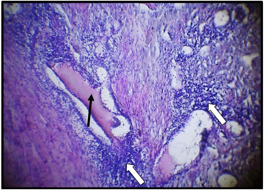 17 Figure 4 : Photomicrograph of skin tissue from Group II showed congestion of the blood vessels in the dermis(black arrow) with obvious perivascular