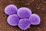 Antimicrobial resistance a growing threat 25 000 Europeans killed / year 1.