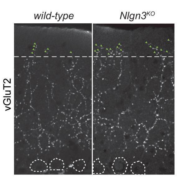 Neuronal alterations in autism models are reversible Re-expression of Nlgn3 in adolescent mice restores