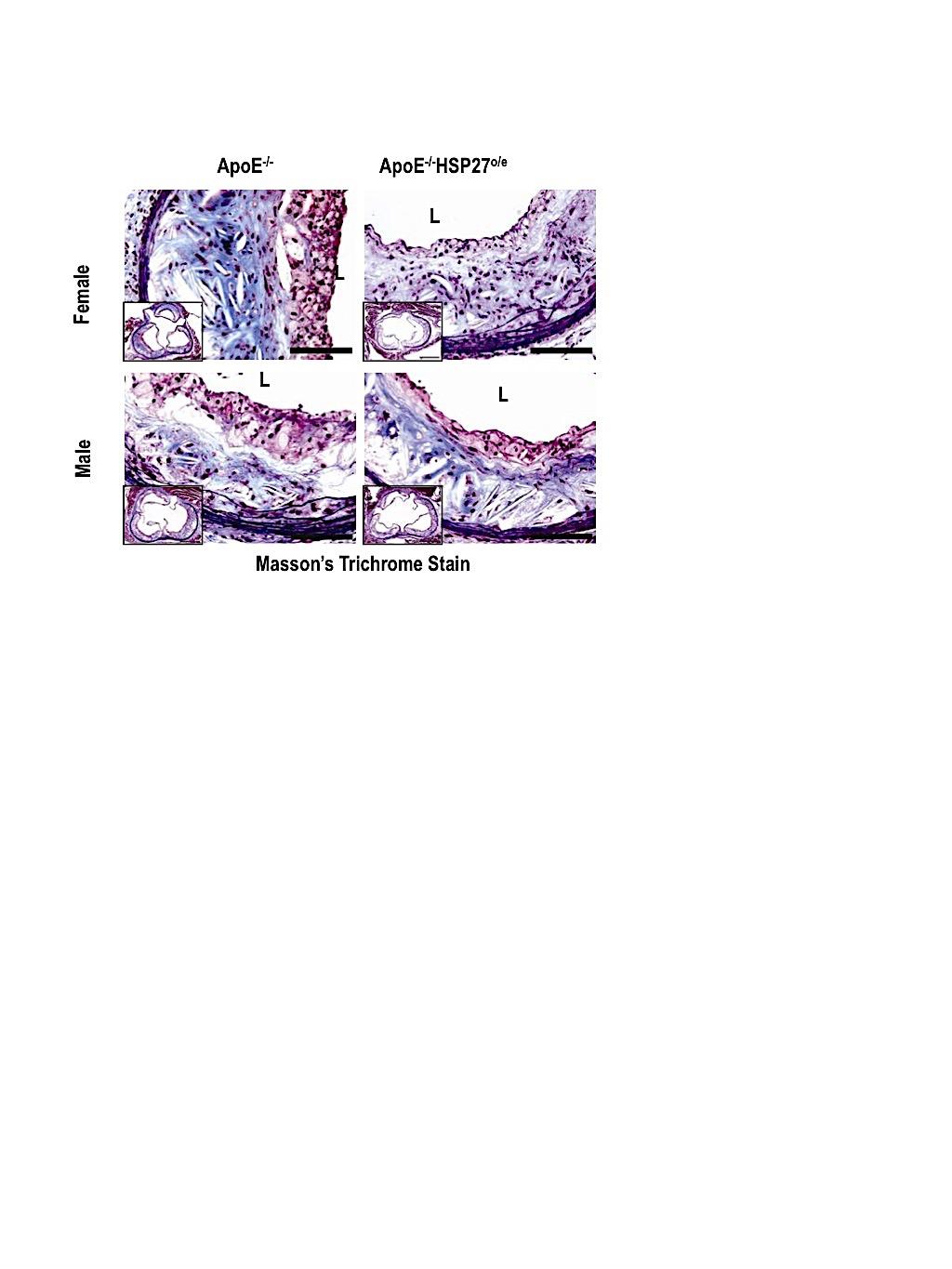 HSP27 Over-Expression Reduces Arterial