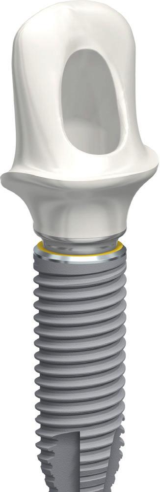 NobelParallel Conical Connection Product overview Access to innovative restorative solutions Take advantage of innovative solutions available only for the