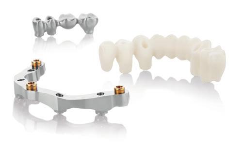 NobelProcera CAD/CAM for restorative flexibility and predictable results Titanium or zirconia abutments that support the surrounding tissue with an individualized emergence profile Cement-free