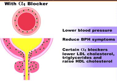 Selective α 1 blockers Prazosin Highly selective α1 blocker & less potent at α 2 receptors.