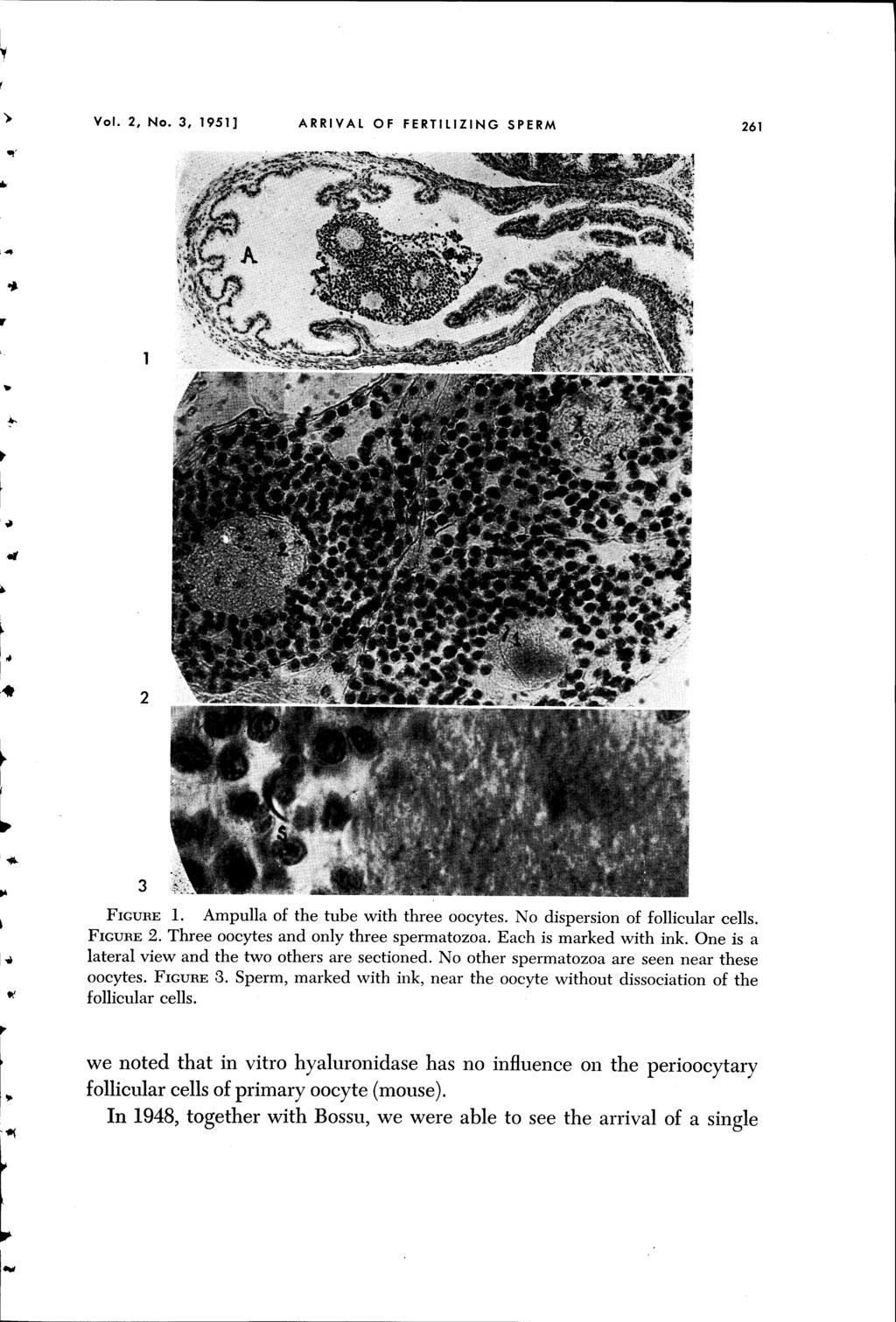 Vol. 2, No.3, 1951] ARRIVAL OF FERTILIZING SPERM 261. ~ l. 2 3 1. Ampulla of the tube with three oocytes. No dispersion of follicular cells. 2. Three oocytes and only three spermatozoa.