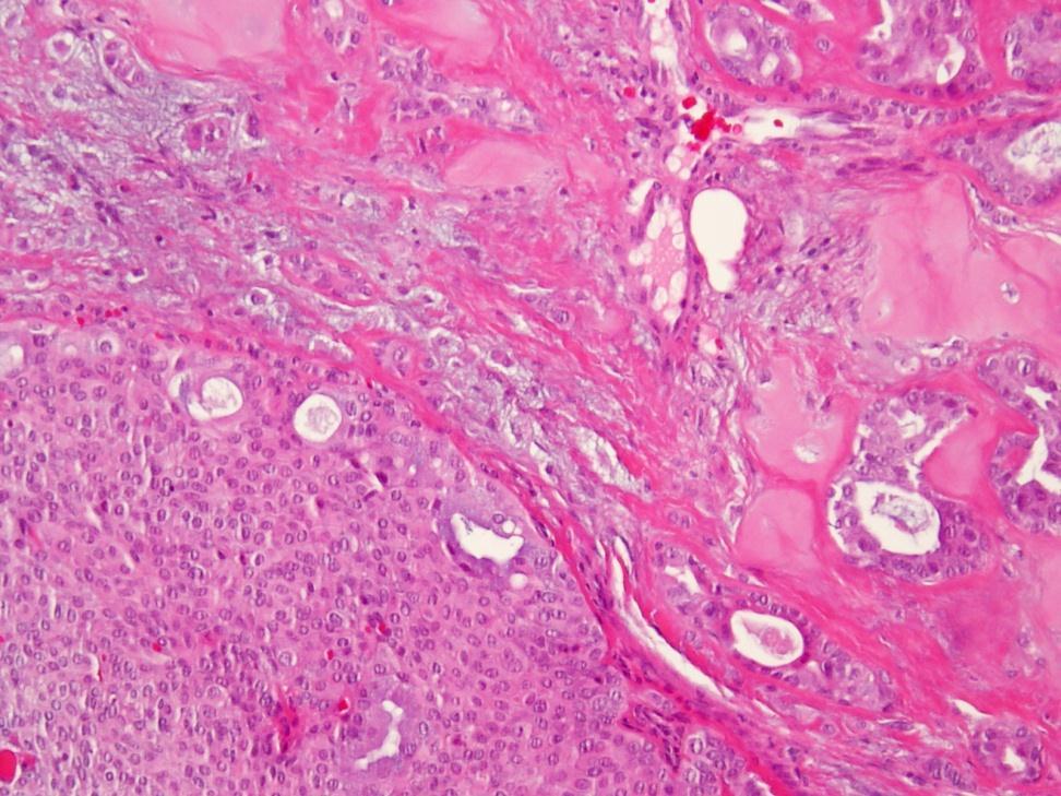 cartilage matrix formation No difference in IHC