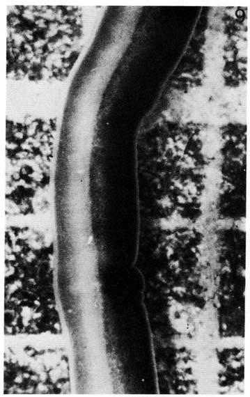 182 S. SIVARADJAM AND J. BIERNE Fig. 6. Dorsal view of a feminized allophenic worm from the FU clone, showing persistence of the difference in pigmentation between the two sides of the body.