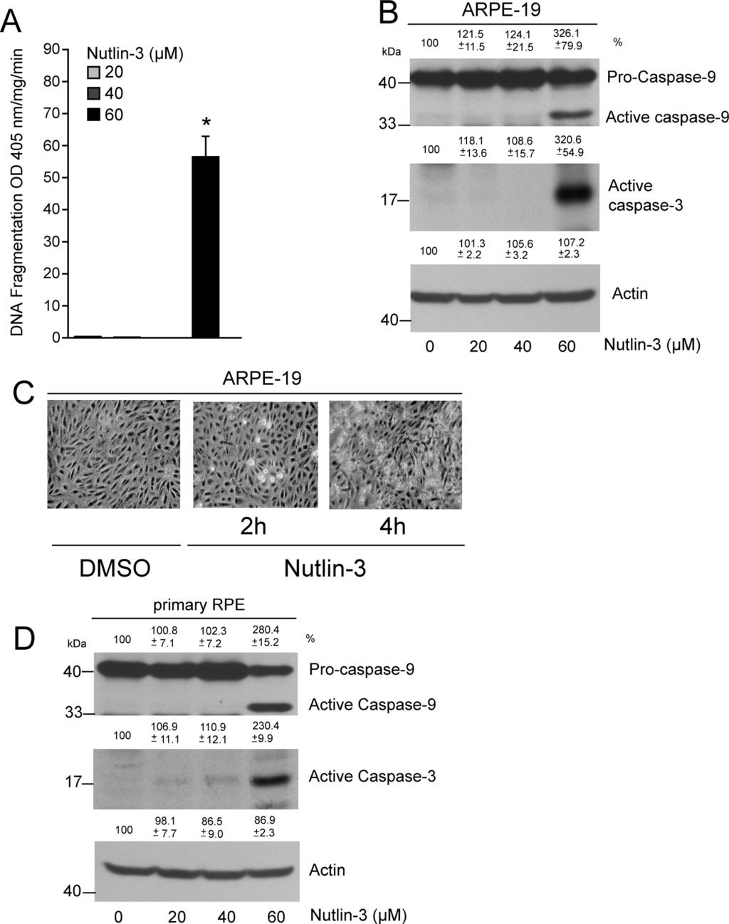 IOVS, May 2011, Vol. 52, No. 6 Nutlin-3 Induces Apoptosis in RPE Cells 3373 FIGURE 4. Nutlin-3 induces apoptosis in ARPE-19 and primary RPE cells.