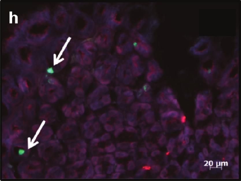 Amyloid deposit targeting with AGuIX@PEG@PIB in pathological tissue.